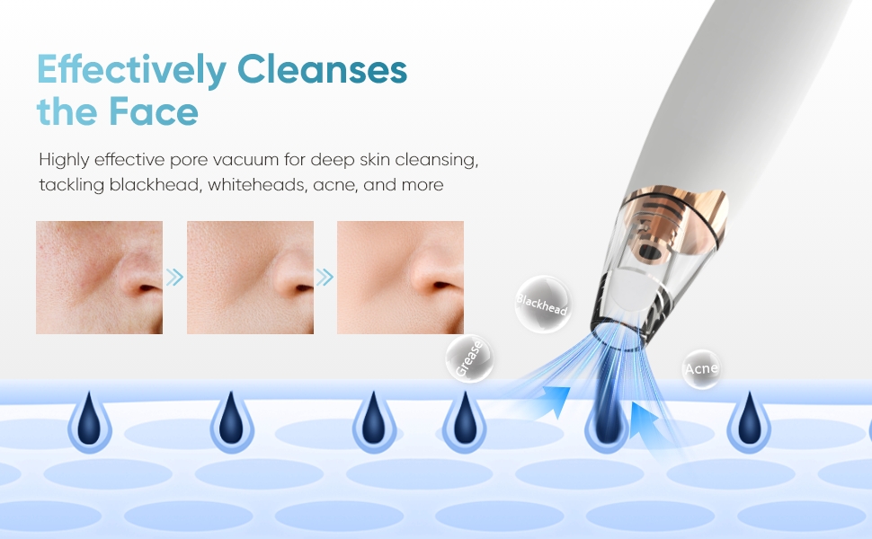 blackhead remover tools