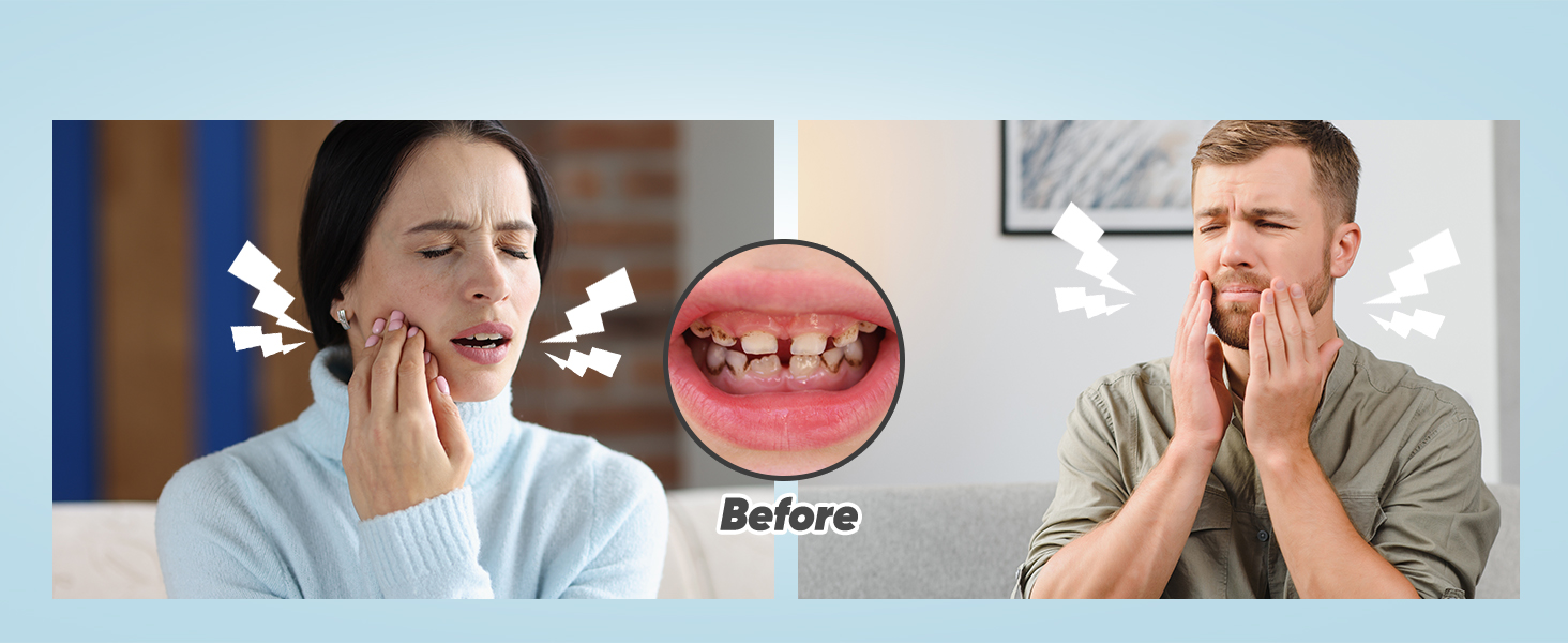 dental polisher