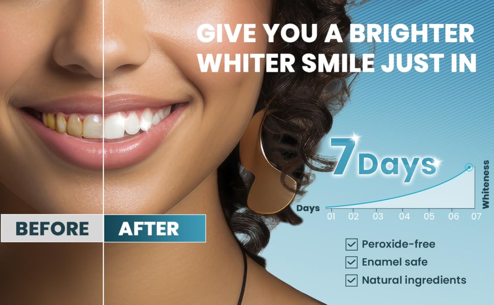 whitening strips