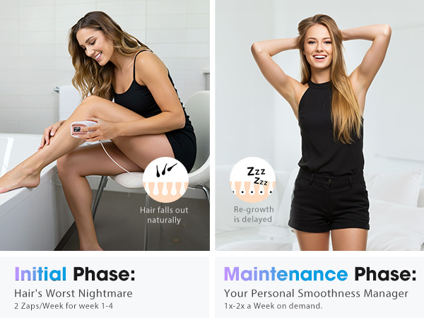 laser hair removal device