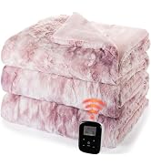 Heated Blanket Queen Size with Wireless Remote &amp;Dual Zone Control, Pink | Faux Fur Heated Comfort...