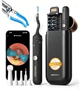 Ear Wax Removal Kit with Camera, HD Waterproof Otoscope &amp; Flexible Tip | Ear Cleaner for Curved E...