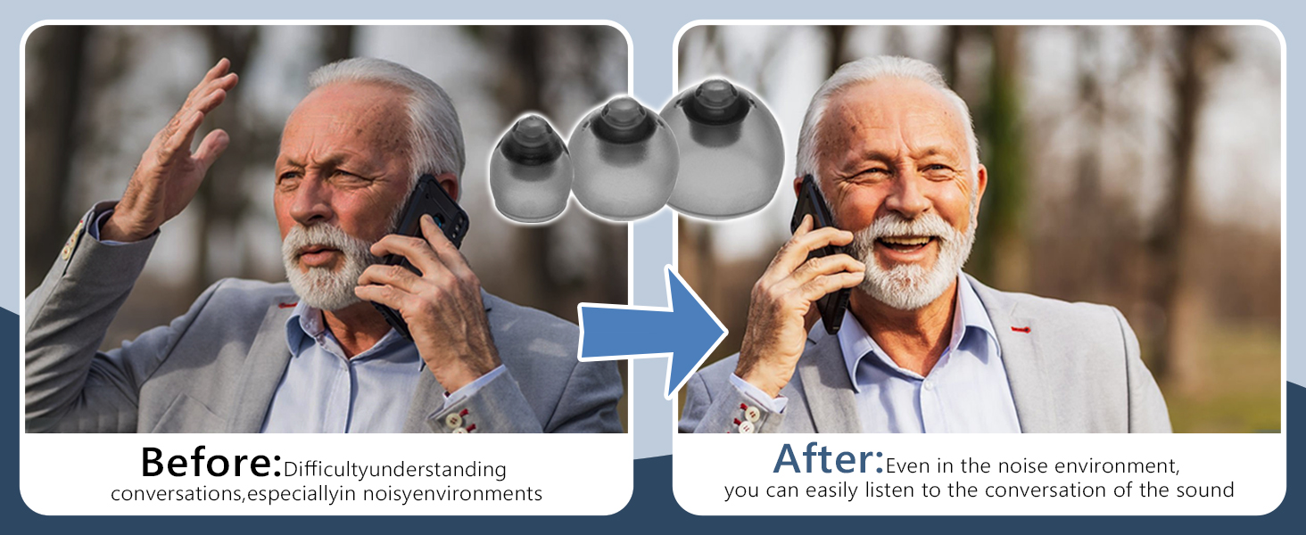 Phonak Hearing Aid Domes