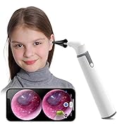 ScopeAround Otoscope with Light, Ear Camera w/Dual View, 720pHD WiFi Ear Scope w/ 6 LED Lights, 3...