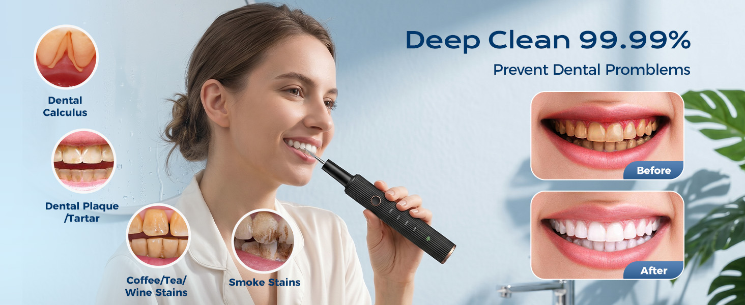 dental tools
