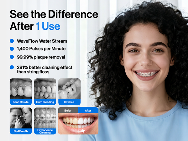 usmile water flosser