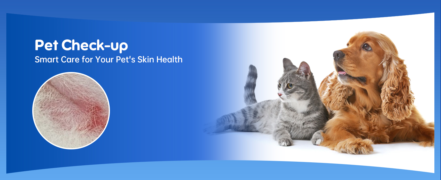 ear cleaner earwax removal