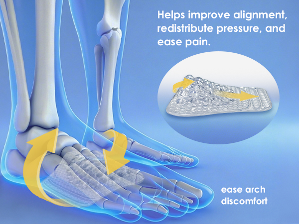 ease arch discomfort help improve alighment redistribure pressure ease pain