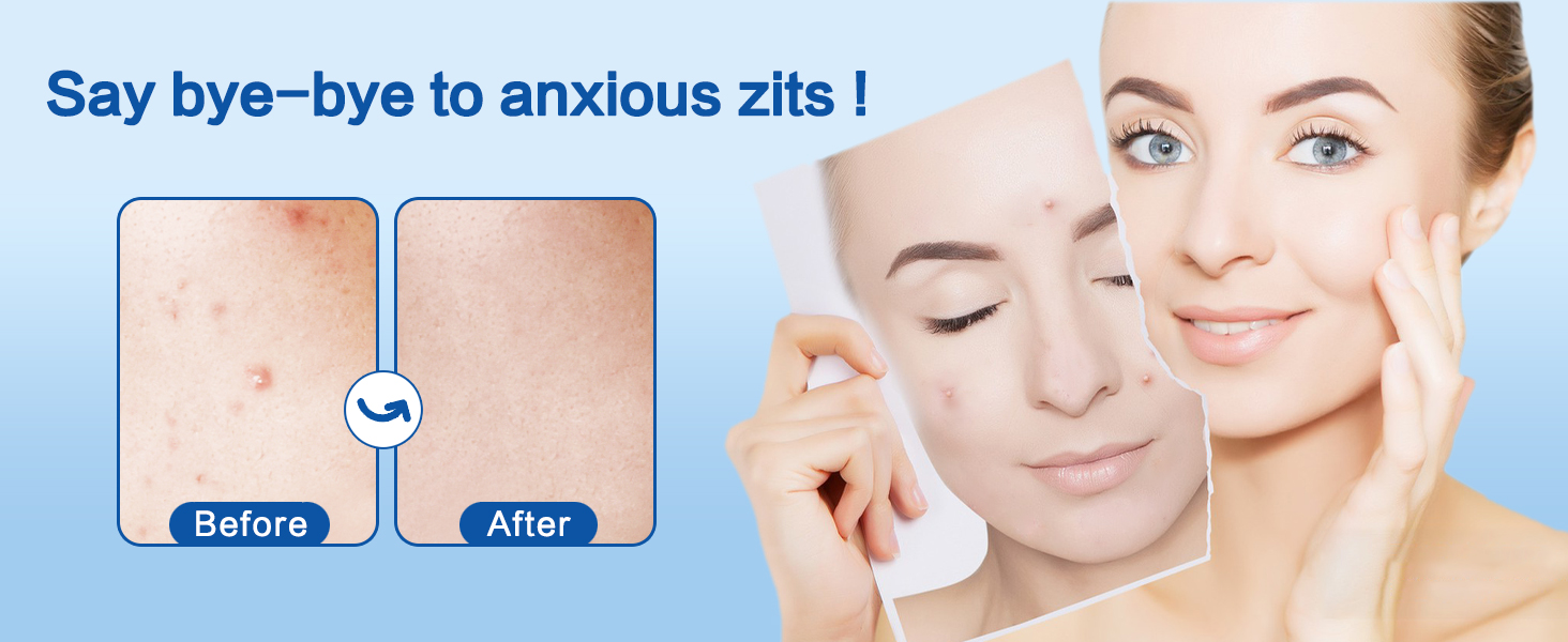 Pimple Patches for Face
