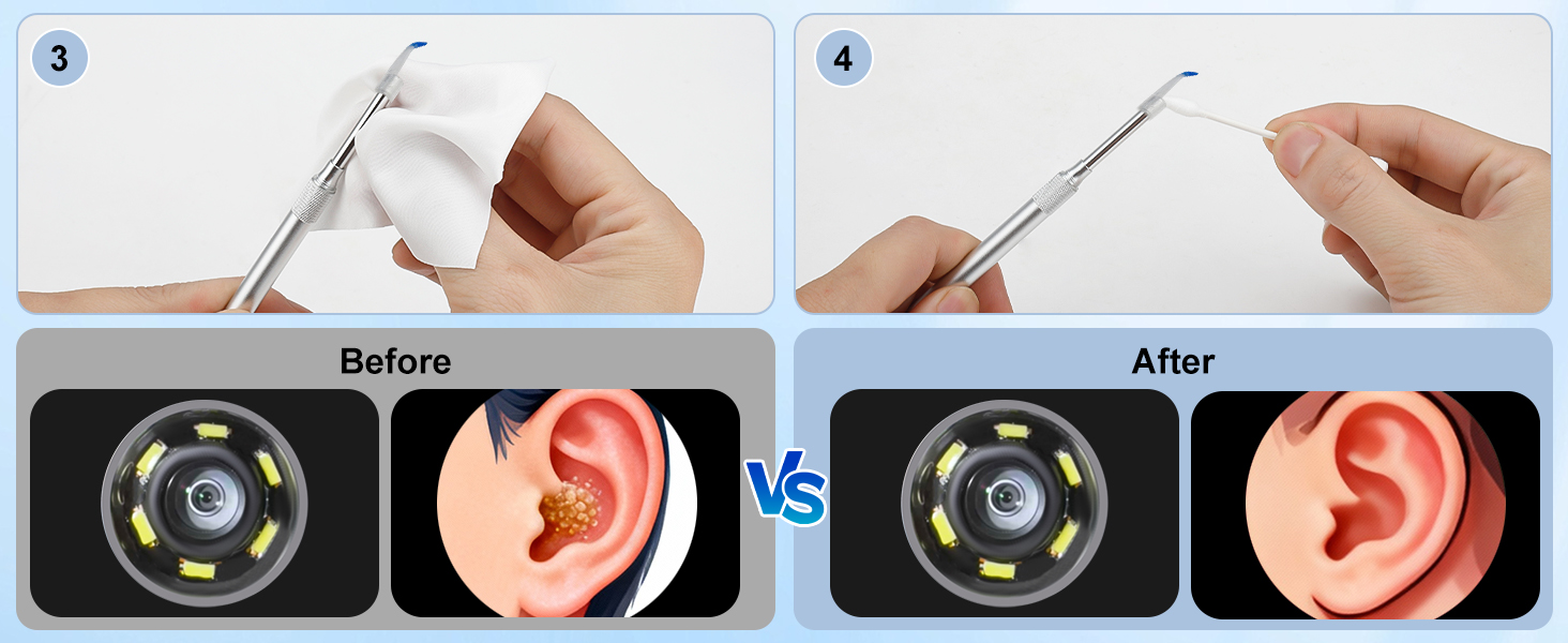 Visual ear wax removal tool before and after effect for ear canal health