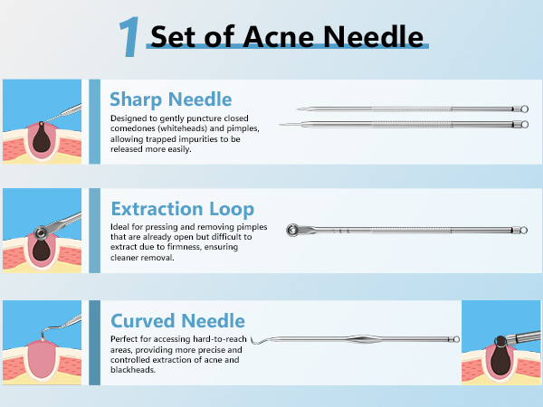 black head remover for face