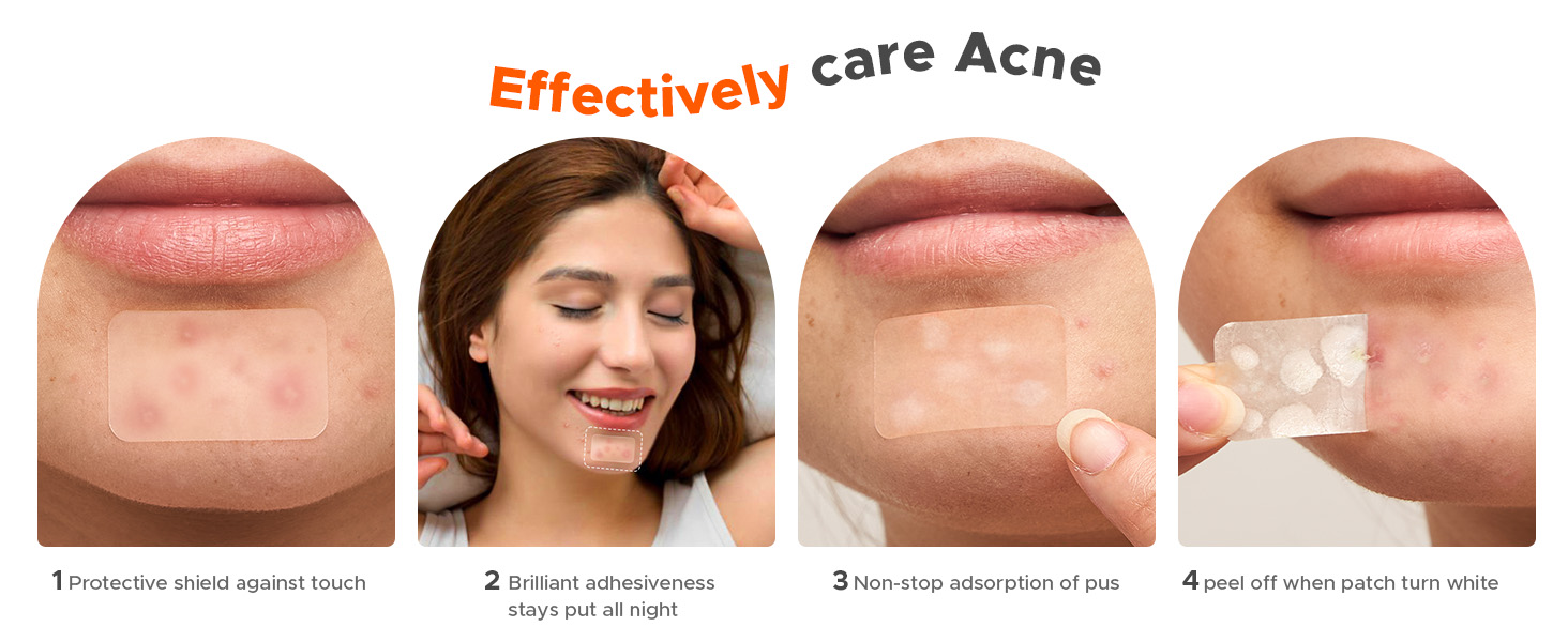 large pimple patches