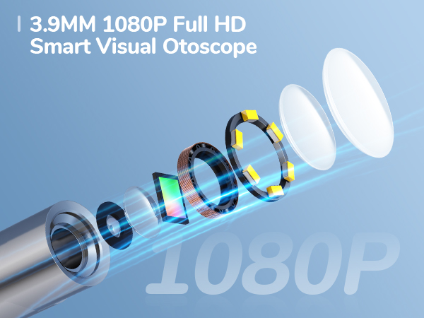 wireless otoscope ear camera