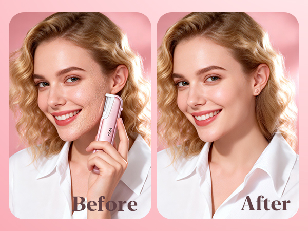 Dermaplane Razor