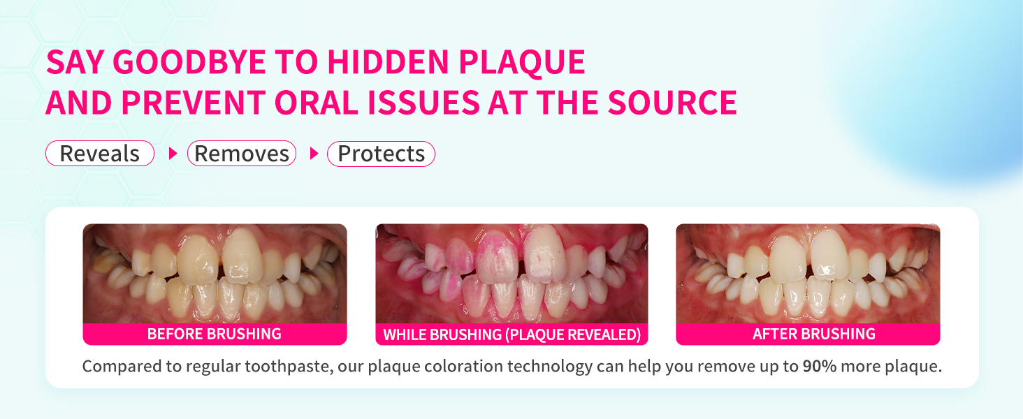 plaque disclosing tablets