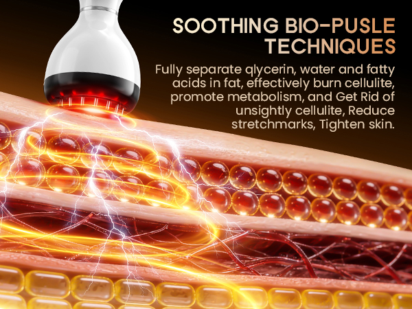 Lymphatic Drainage Massager &amp;amp; Anti Cellulite Massage Tool