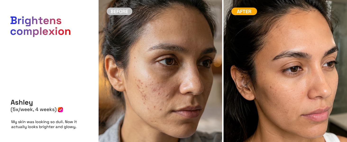 Brightens complexion