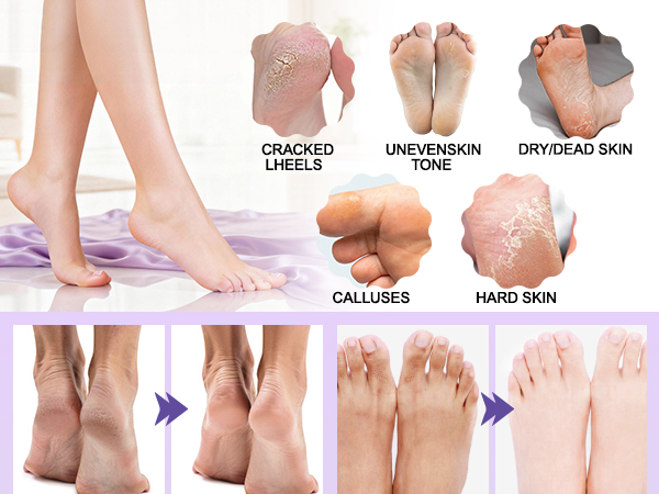 foot mask