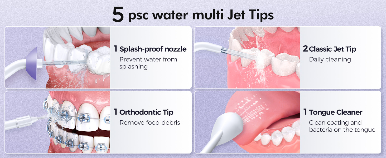 5 jet tips