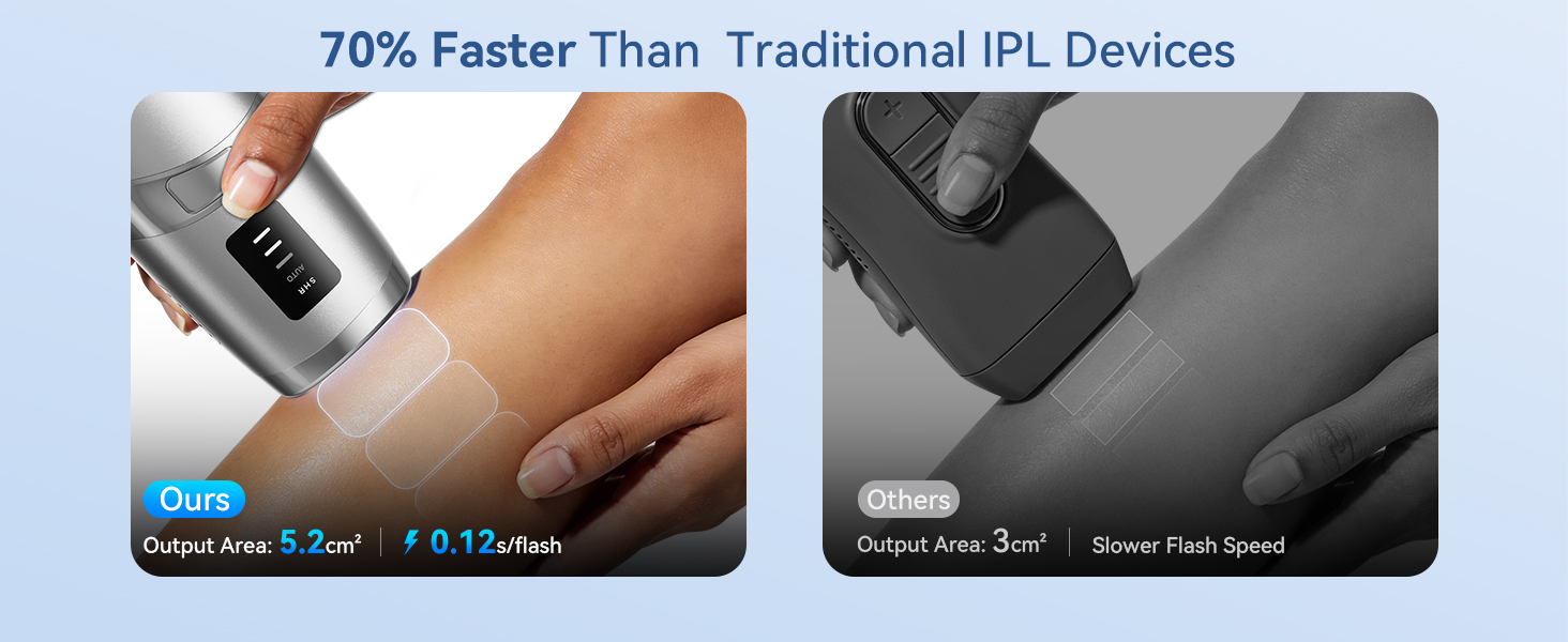 Laser hair removal for women