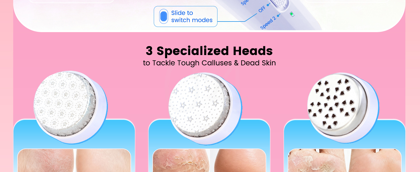 electric callus remover