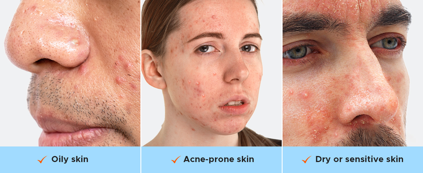 For all skin types