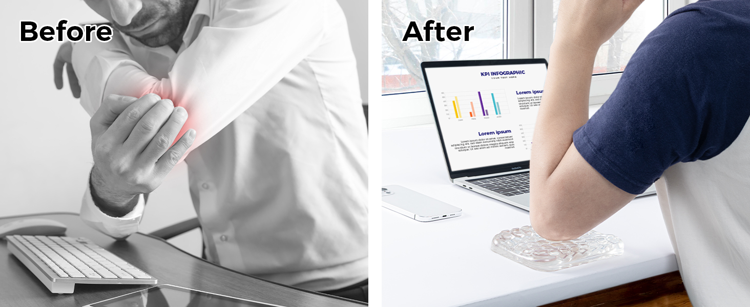 Ergonomic Keyboard Elbow Rest Pad