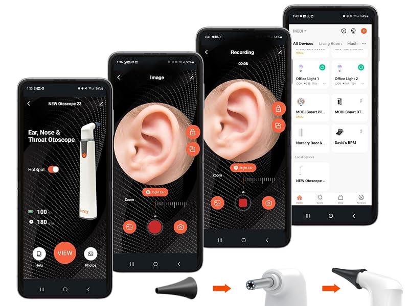  The MOBI Smart Otoscope Jr. examines ears, noses, and throats in humans and pets