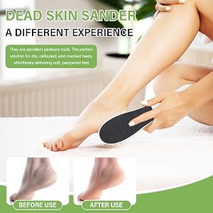 cracked heel remover