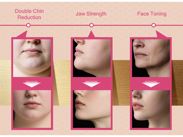 jawline shaper