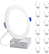 Lepro 12 Pack 6 Inch Canless LED Recessed Light,Dimmable Retrofit Ultra-Thin Ceiling Light with J...