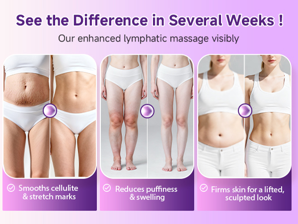 Lymphatic Drainage Massager, Anti Cellulite Massage Tool