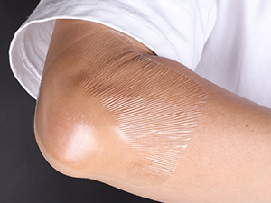 Transparent Film Dressing