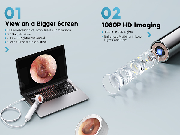 Otoscope