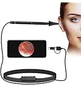 Jiusion 3.9mm Ultra-Thin Portable USB Digital Otoscope Camera with Carrying Case, HD 720P 6 LED V...