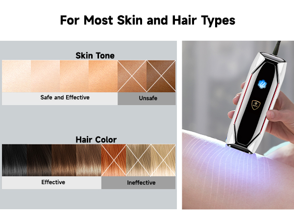facial hair removal for women