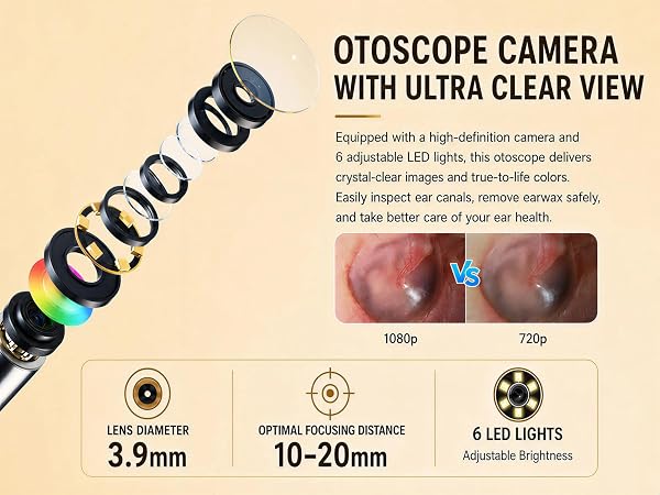 OTOSCOPE CAMERAWITH ULTRA CLEAR VIEW