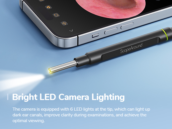 Otoscope