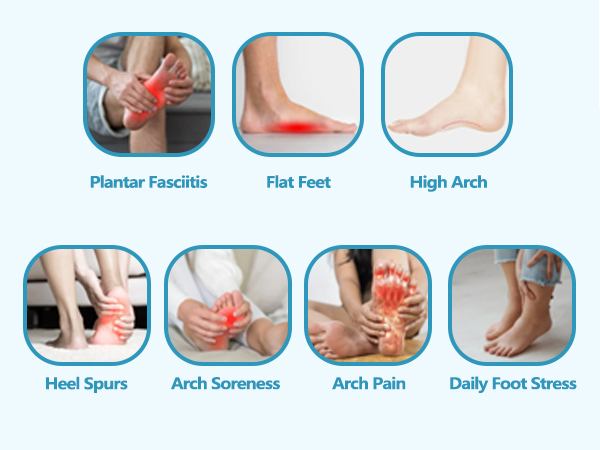 plantar fasciitis support brace arch support bands for plantar fasciitis