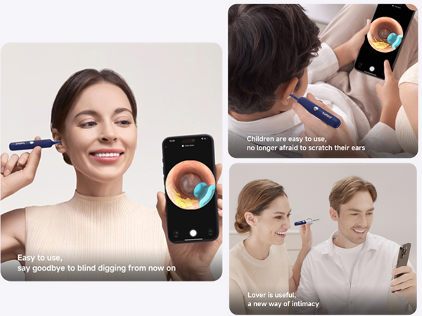 Bebird Earsight Plus Wireless Ear Wax Removal Tool