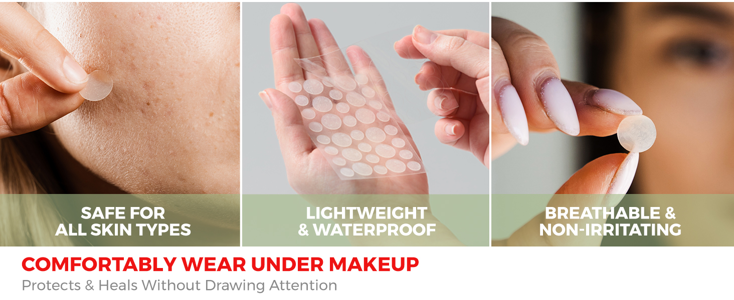 pimple patches, acne patches, pimple patches for face