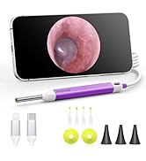 HD Digital Otoscope, Video Ear Scope Otoscope with Light, Ultra Clear View Ear Camera with Ear Wa...