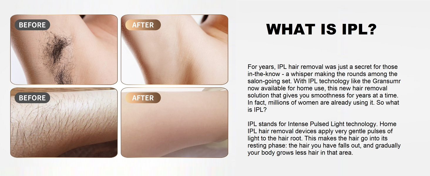 Laser Hair Removal Device Home Use IPL Laser Beauty Device 6