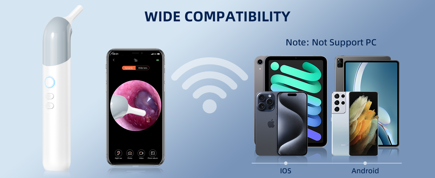 otoscope ear camera