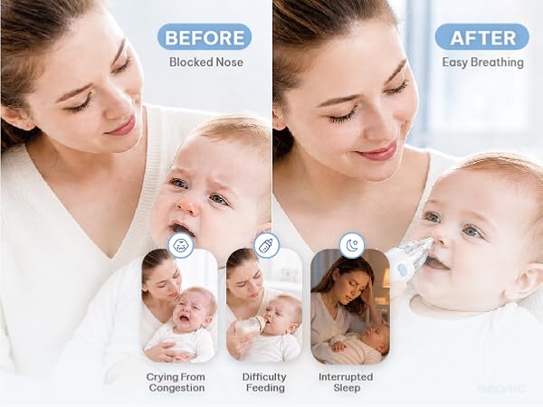 GEONIC electric nasal aspirator to clear a baby&amp;#39;s nose safely and comfortably.