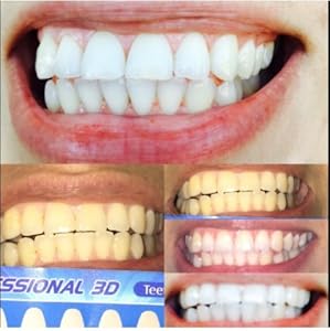 Cool Teeth Whitening Reviews