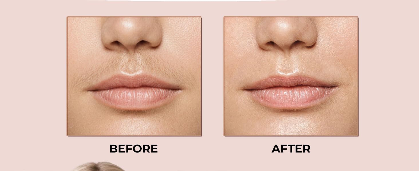 Facial Hair Removal for Women