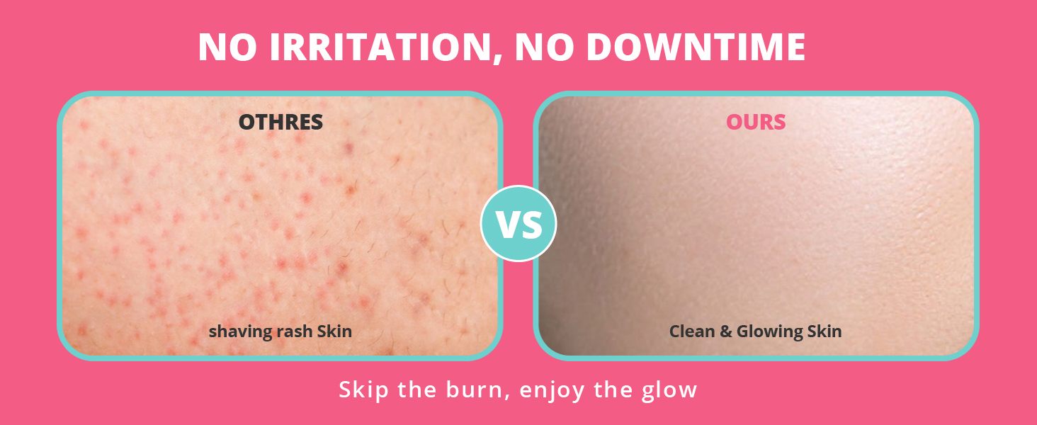 No irritation, no downtime