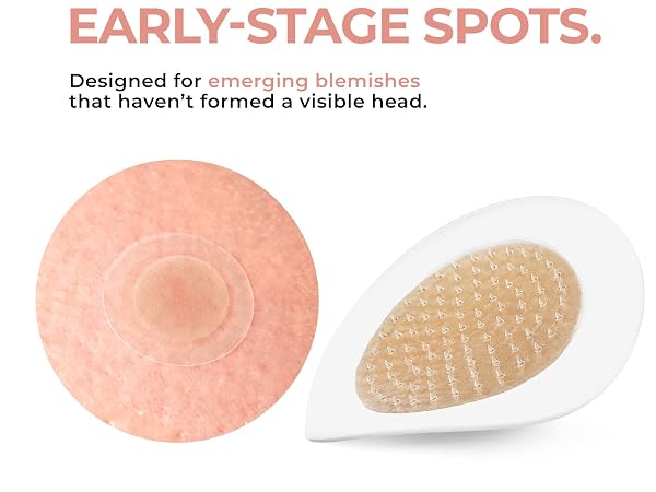 Early stage spots. Designed for emerging blemishes that haven't formed a visible head.