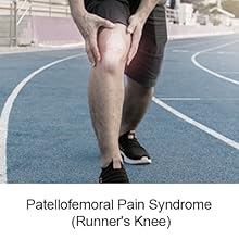 Patellofemoral Pain Syndrome (Runne&amp;#39;s nee)